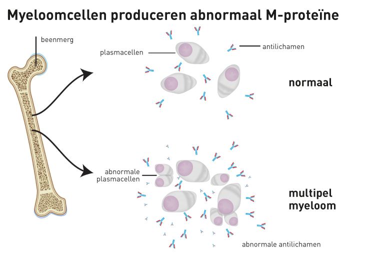 myeloomcellen