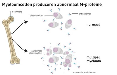 myeloomcellen
