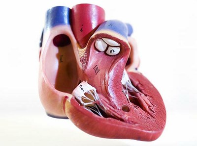 Dabigatran: verhoogd risico op hartinfarct
