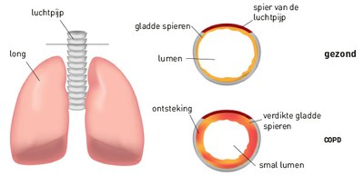 MeMO-COPD-programma blijkt (kosten)effectief