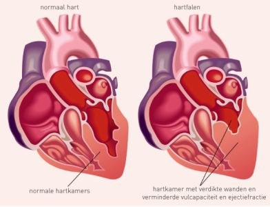 Hartonderzoek voortzetten na trastuzumab