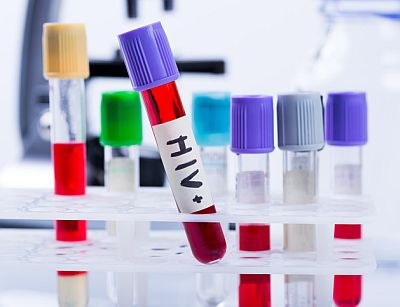 Hiv-screening loont