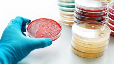 Subsidie voor onderzoek naar nieuwe antibiotica