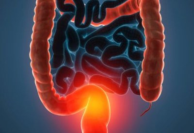 Biosimilar van infliximab vergelijkbaar met origineel 