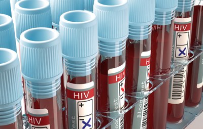 Hoop op hiv-remmer met meervoudige effectiviteit