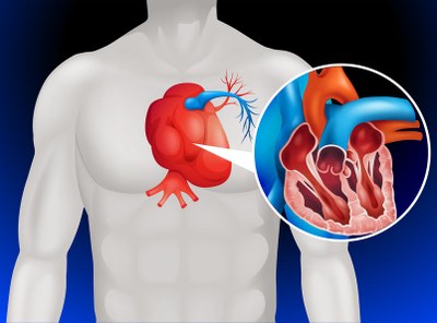 Onderzoek digoxine als nieuwe behandeling hartfalen