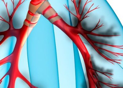 Bètablokkers niet onthouden bij COPD en hartprobleem