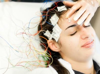 Focale epilepsie: beter anti-epilepticum vervangen dan add on
