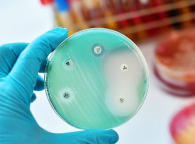 RIVM: snellere test kan gebruik antibioticum verbeteren