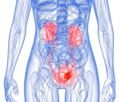 Beleid urineweginfecties gericht op minder resistentie