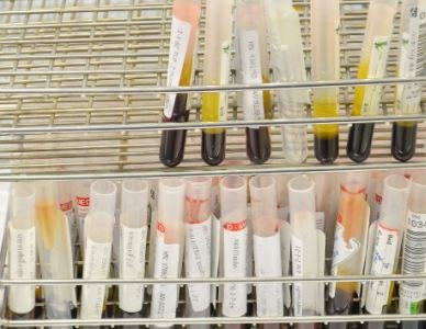 Miljoen testen op corona-antistoffen in bloed aangekocht
