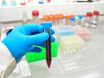 Nieuwe bloedtest onderscheidt soorten dementie