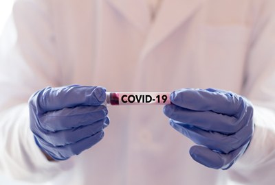 Sanquin verzamelt plasma voor geneesmiddel COVID-19