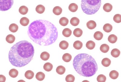 Uitbreiding toepassing Daratumumab