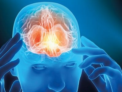 Nieuwe CGRP-remmers voor migraine in basispakket