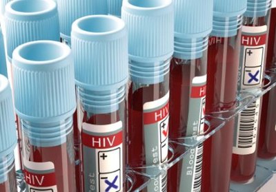 Anti-parasitair medicijn ontwaakt virus hiv-patiënt 
