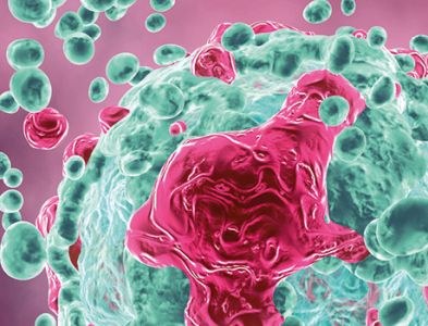 Pembrolizumab breder inzetbaar bij niet-kleincellig longcarcinoom