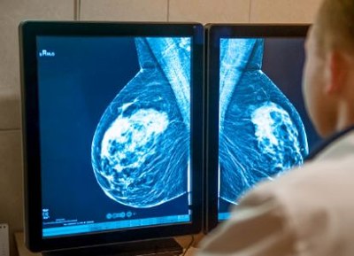 Twee testen bij borstkanker vergoed uit basispakket 