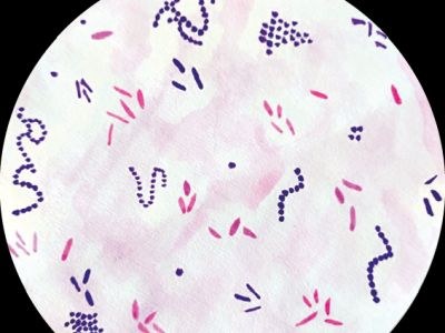 Lepramiddel ook effectief bij niet-tuberculeuze mycobacteriën
