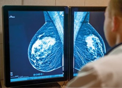 Zorginstituut gaat abemaciclib herbeoordelen na uitspraak 