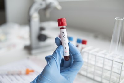 Groen licht voor veelbelovende PrEP-injectie