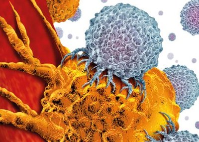 LUMC: eerste Nederlandse patiënt behandeld met CAR-T-cellen