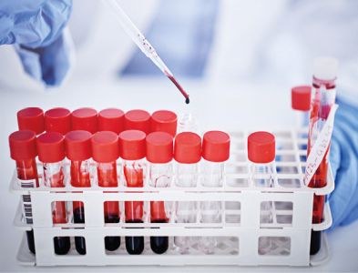 Veel problemen bij opstarten klinische studies in Europa