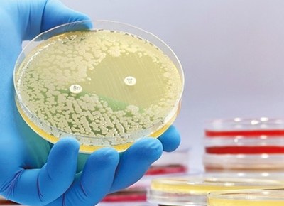 WHO waarschuwt voor wereldwijde toename resistentie antibiotica